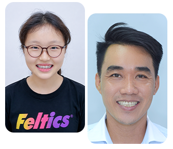 Chỉnh nha trẻ em và chỉnh nha tăng trưởng cùng BS. Trương Thùy Trang