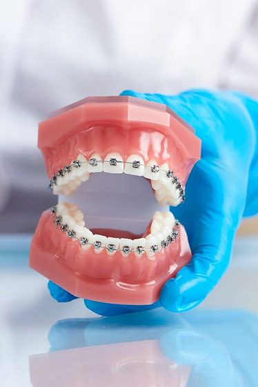 BS. Trương Thùy Trang ứng dụng hệ thống tạo lực trong chỉnh nha mắc cài