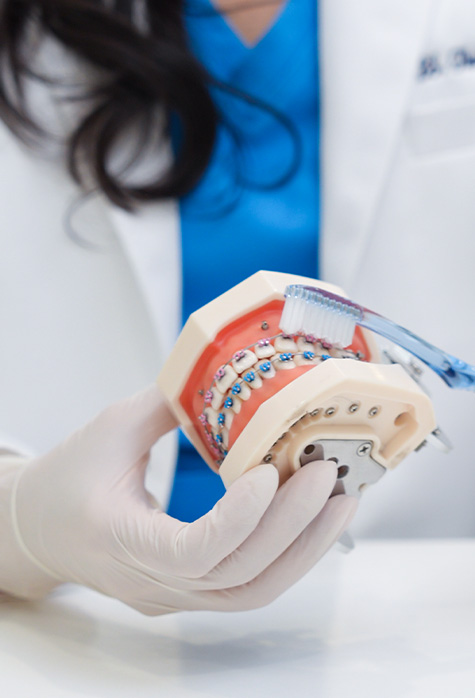 BS. Trương Thùy Trang kiểm soát chỉnh nha mắc cài theo từng giai đoạn điều trị