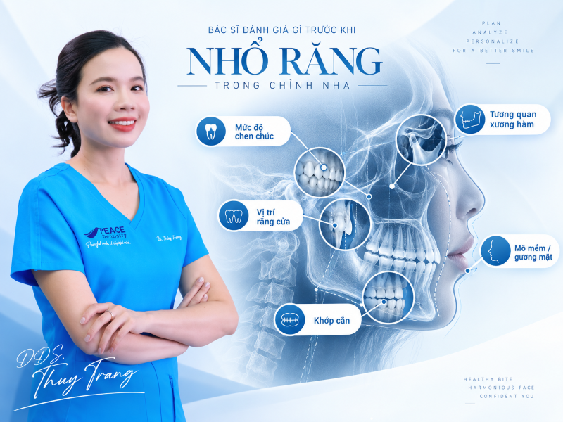 BS. Trương Thùy Trang đánh giá các yếu tố trước khi quyết định nhổ răng chỉnh nha