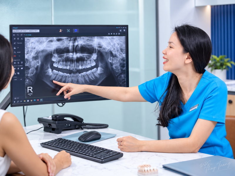 BS. Trương Thùy Trang phân tích phim Panorama trong quá trình chẩn đoán chỉnh nha