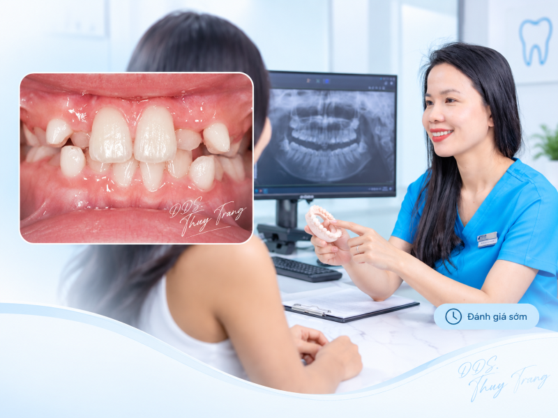 BS. Trương Thùy Trang đánh giá tình trạng răng chen chúc và phim X-quang