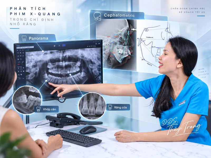BS. Trương Thùy Trang phân tích phim X-quang trước khi quyết định nhổ răng trong chỉnh nha