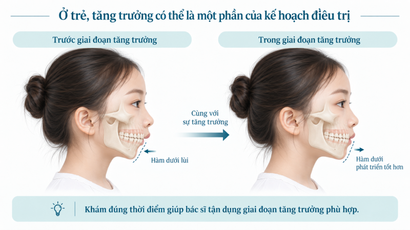 Minh họa điều chỉnh tăng trưởng ở trẻ có hàm dưới lùi trong kế hoạch điều trị hô
