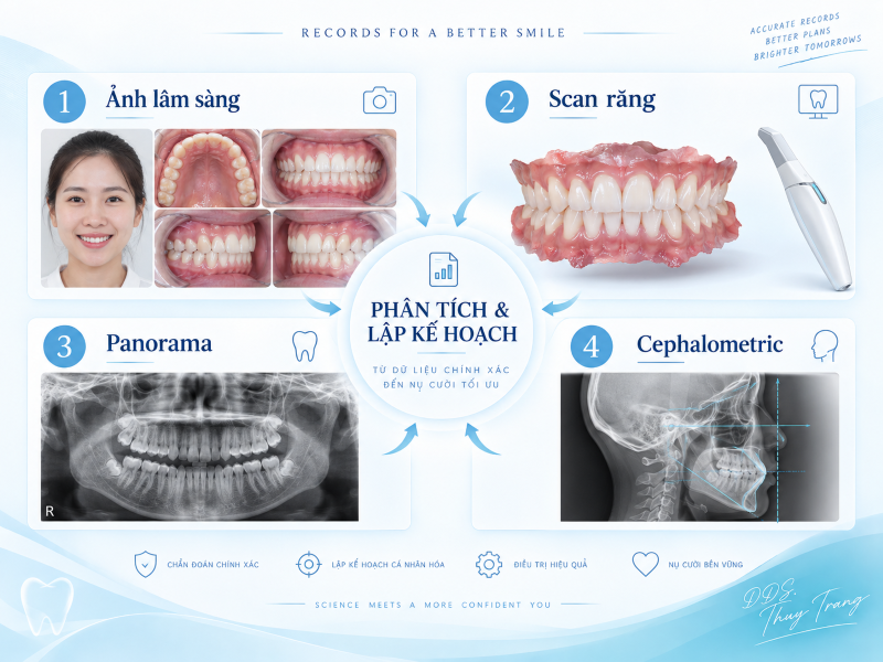 Hồ sơ phân tích và lập kế hoạch chỉnh nha gồm ảnh lâm sàng, scan răng, phim Panorama và Cephalometric