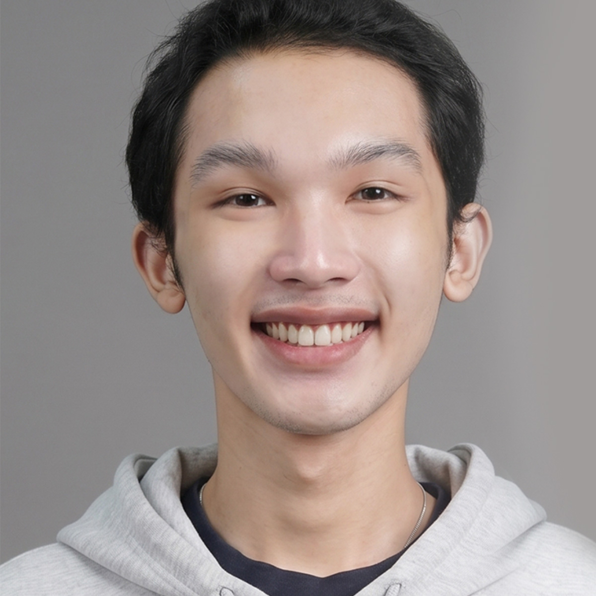 Khách hàng người trưởng thành trong hành trình chỉnh nha cùng BS. Trương Thùy Trang